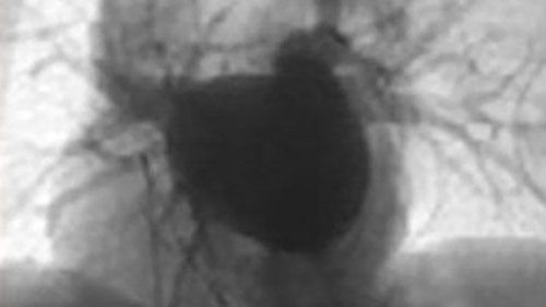 Rotational 1 desktop