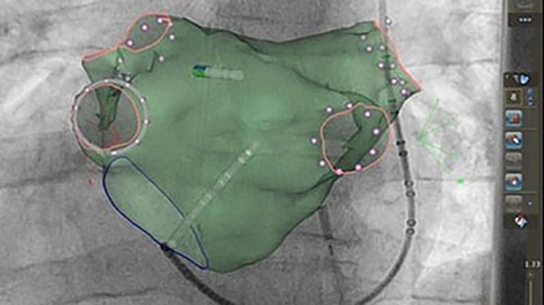 Rotational 4 desktop