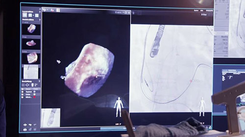 echonavigator video2 desktop