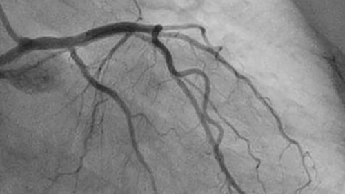 allura centron 6 desktop