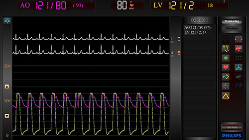 xper flex cardio desktop