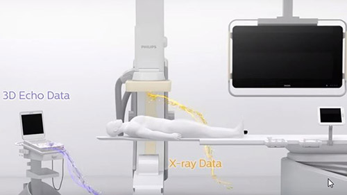 echonavigator video1 desktop