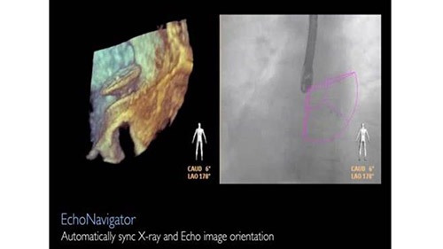 echonavigator2 desktop