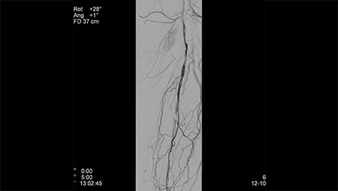 allura clarity clarityiq endovascular 1 desktop