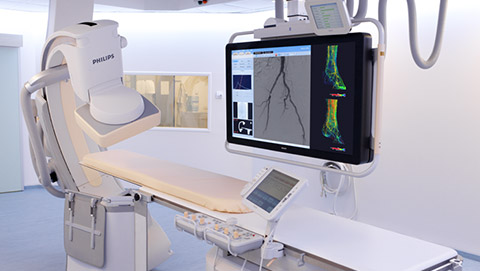 allura clarity clarityiq endovascular 2 desktop