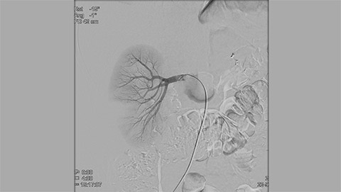 allura clarity clarityiq endovascular 4 desktop