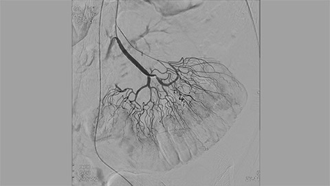 allura clarity clarityiq endovascular 6 desktop