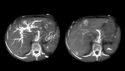 flexvision xl endovascular desktop