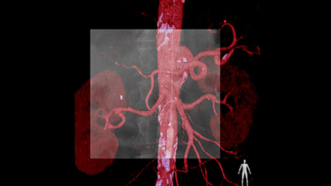 live rd mr ct roadmap desktop