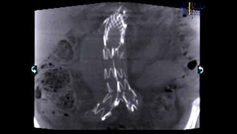 xperct vascular desktop