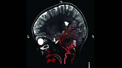 MR CT Roadmap 3D L M