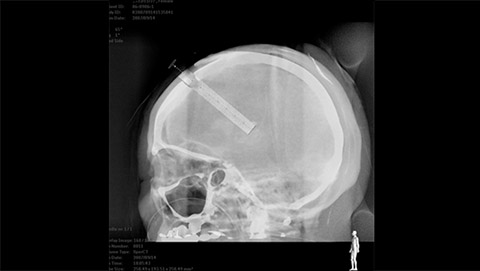 advanced stroke suite 2 desktop