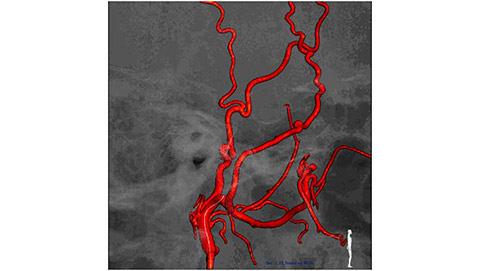 mr ct roadmap 2 desktop